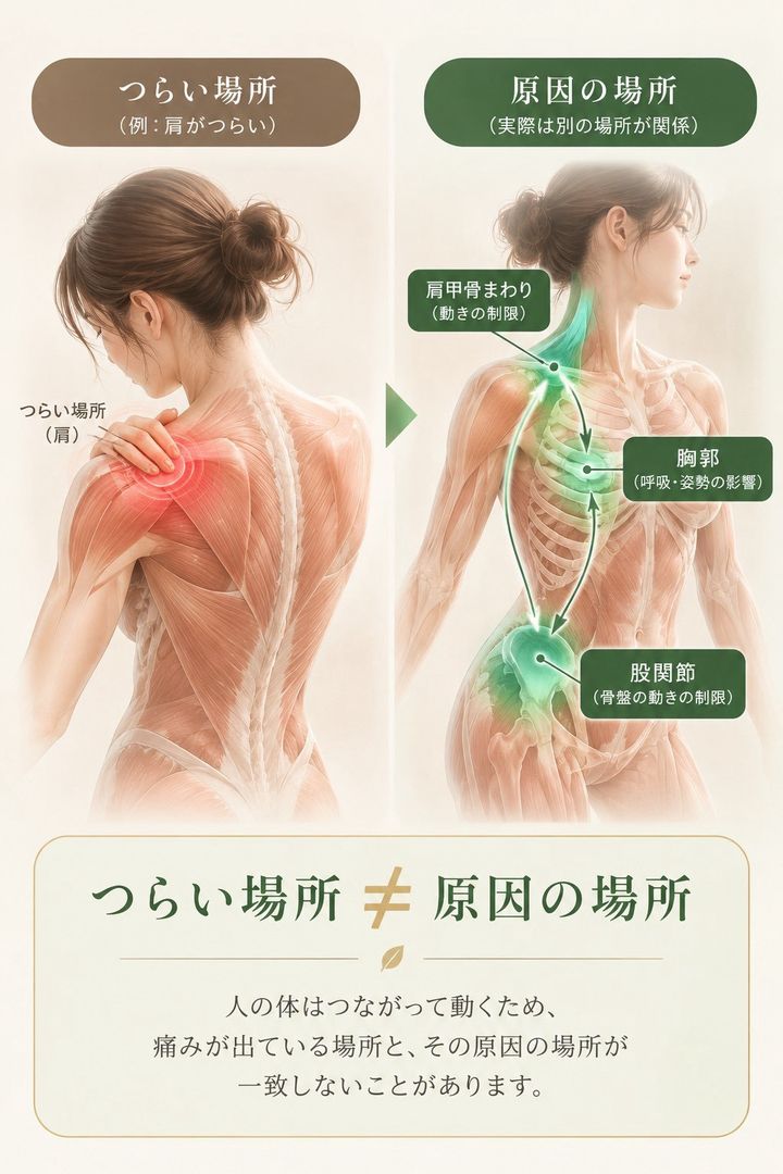 肩がつらい場合でも、肩甲骨まわり・胸郭・股関節など別の場所の動きが関係していることがあることを示したイラスト